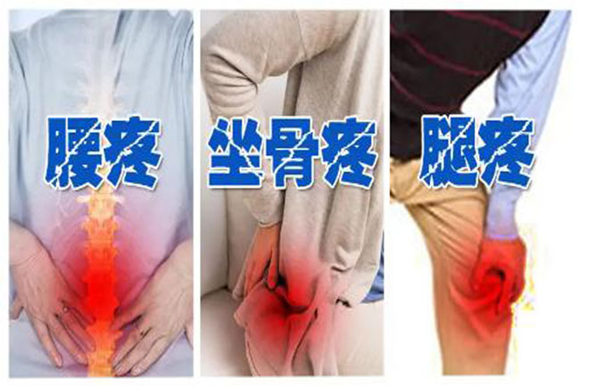 腰椎間盤突出坐姿、睡姿、日常鍛煉、最好治療方法