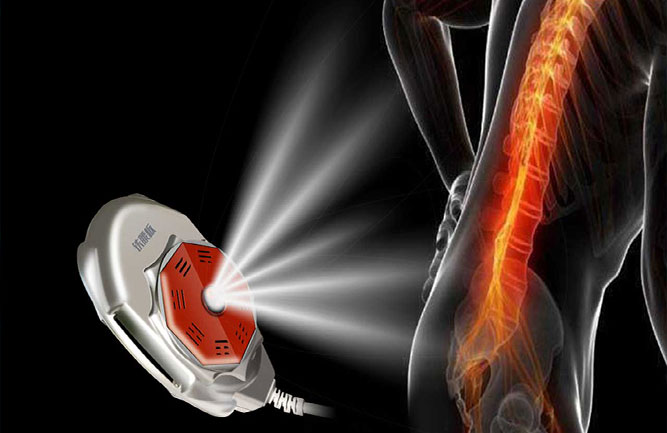 鐵腰板是腰椎間盤(pán)突出最好的治療方法