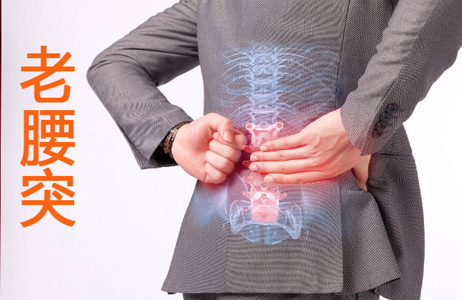 那么什么才是腰椎間盤突出最好的治療方法呢 那么什么才是腰椎間盤突出最好的治療方法呢
