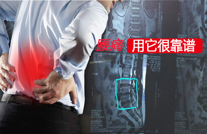 治好腰間盤突出的方法 治好腰間盤突出的方法