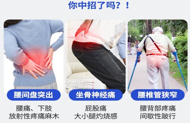 腰間盤(pán)突出怎么鍛煉好的快 腰間盤(pán)突出怎么鍛煉好的快